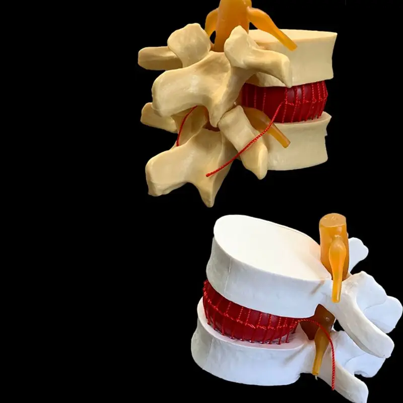 Anatomical Human Lumbar Verteb - Examination Bed Medical 评论和价格