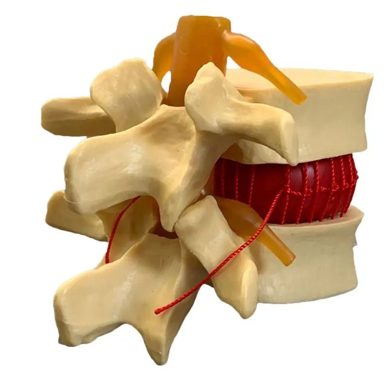 Anatomical Human Lumbar Verteb - Examination Bed Medical 评论和价格