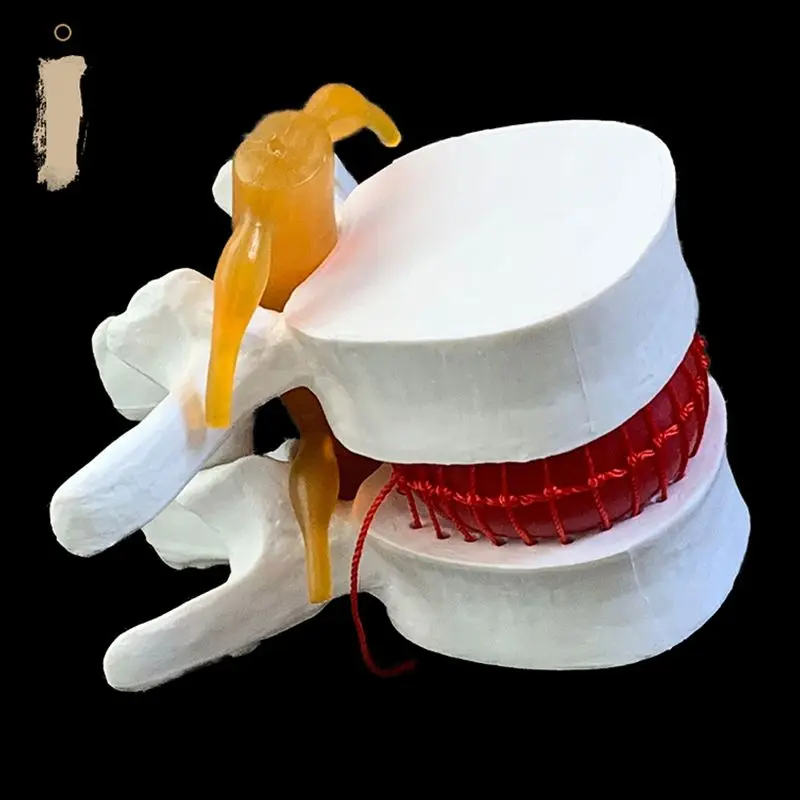 Anatomical Human Lumbar Verteb - Examination Bed Medical 评论和价格