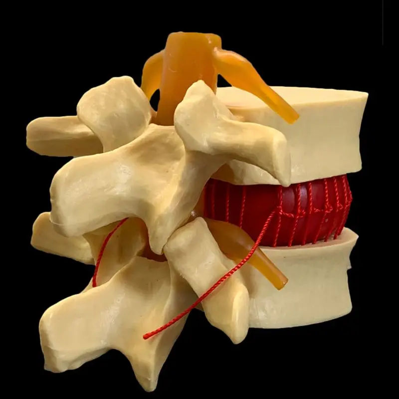 Anatomical Human Lumbar Verteb - Examination Bed Medical 评论和价格